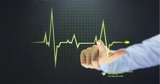 Which Heart Rate Monitor is Best For Your Clients?